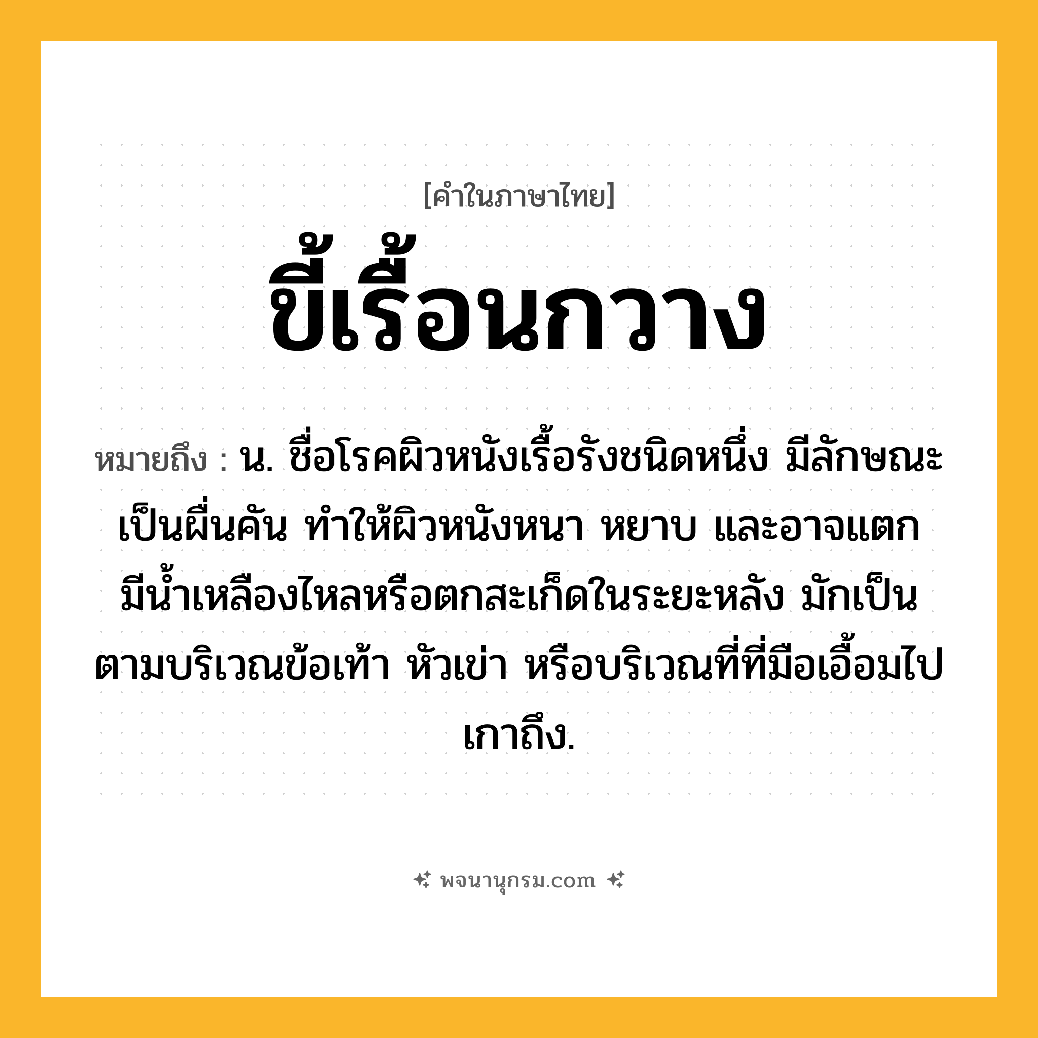 ขี้เรื้อนกวาง ความหมาย หมายถึงอะไร?, คำในภาษาไทย ขี้เรื้อนกวาง หมายถึง น. ชื่อโรคผิวหนังเรื้อรังชนิดหนึ่ง มีลักษณะเป็นผื่นคัน ทําให้ผิวหนังหนา หยาบ และอาจแตกมีนํ้าเหลืองไหลหรือตกสะเก็ดในระยะหลัง มักเป็นตามบริเวณข้อเท้า หัวเข่า หรือบริเวณที่ที่มือเอื้อมไปเกาถึง.