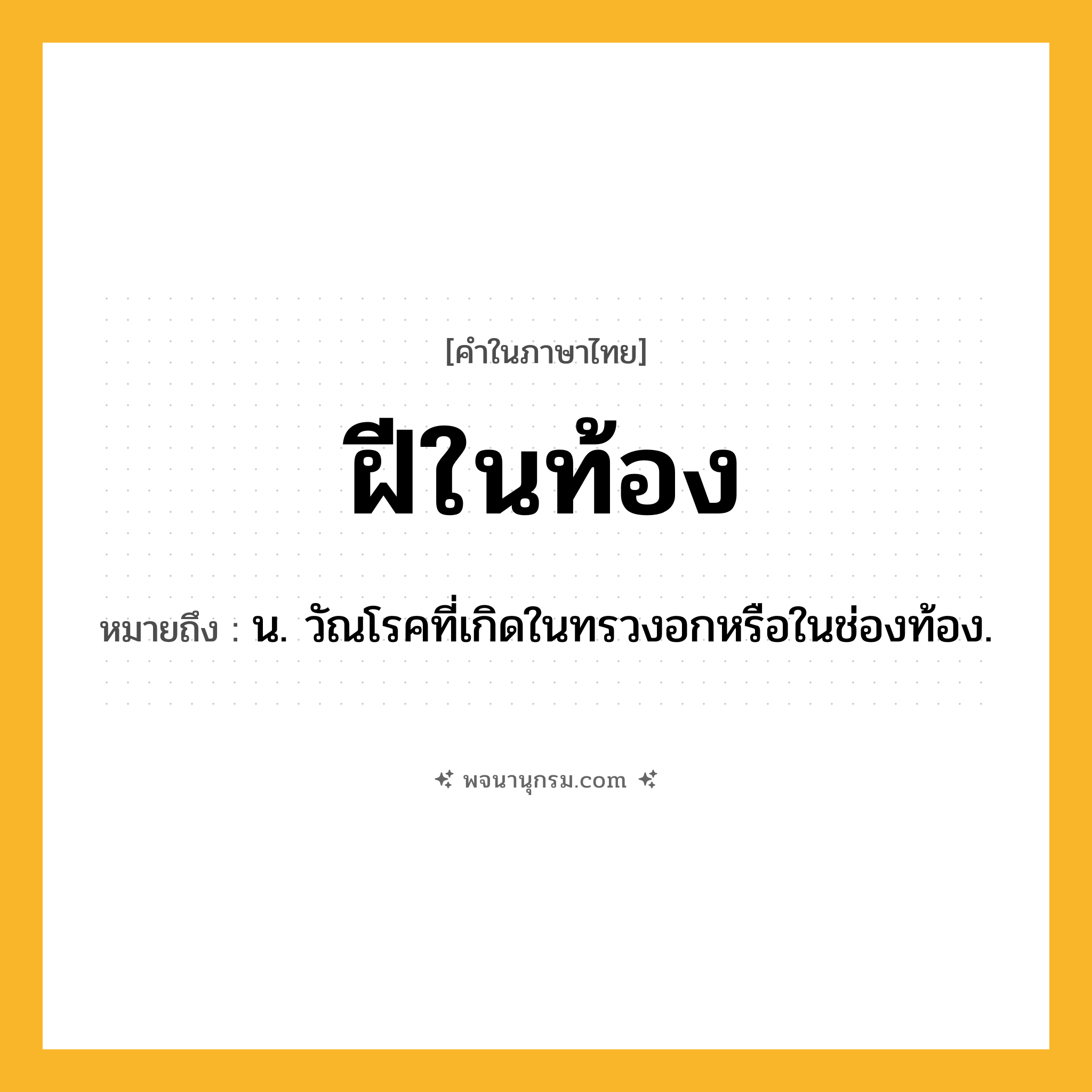 ฝีในท้อง ความหมาย หมายถึงอะไร?, คำในภาษาไทย ฝีในท้อง หมายถึง น. วัณโรคที่เกิดในทรวงอกหรือในช่องท้อง.