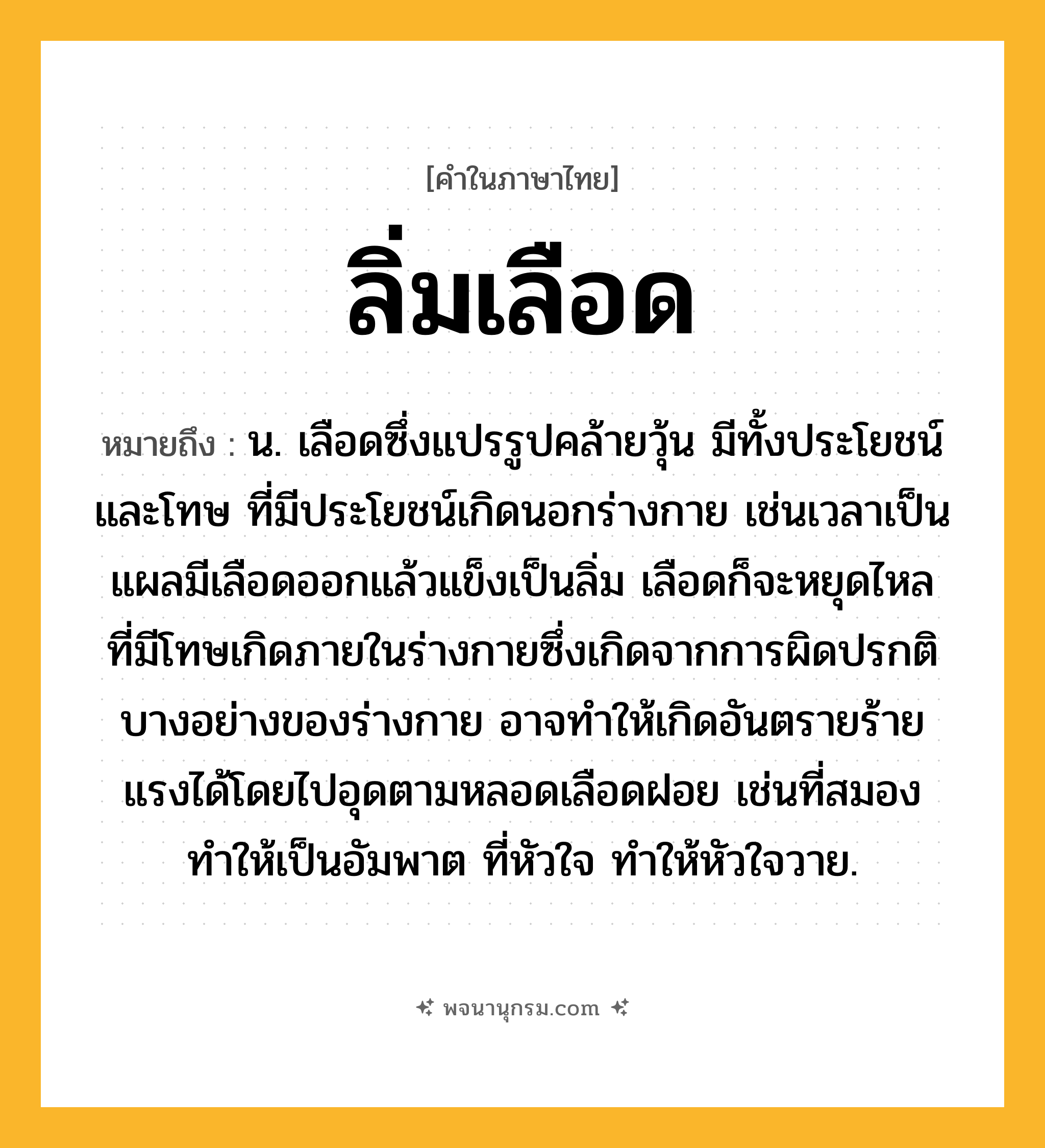 ลิ่มเลือด ความหมาย หมายถึงอะไร?, คำในภาษาไทย ลิ่มเลือด หมายถึง น. เลือดซึ่งแปรรูปคล้ายวุ้น มีทั้งประโยชน์และโทษ ที่มีประโยชน์เกิดนอกร่างกาย เช่นเวลาเป็นแผลมีเลือดออกแล้วแข็งเป็นลิ่ม เลือดก็จะหยุดไหล ที่มีโทษเกิดภายในร่างกายซึ่งเกิดจากการผิดปรกติบางอย่างของร่างกาย อาจทำให้เกิดอันตรายร้ายแรงได้โดยไปอุดตามหลอดเลือดฝอย เช่นที่สมอง ทำให้เป็นอัมพาต ที่หัวใจ ทำให้หัวใจวาย.