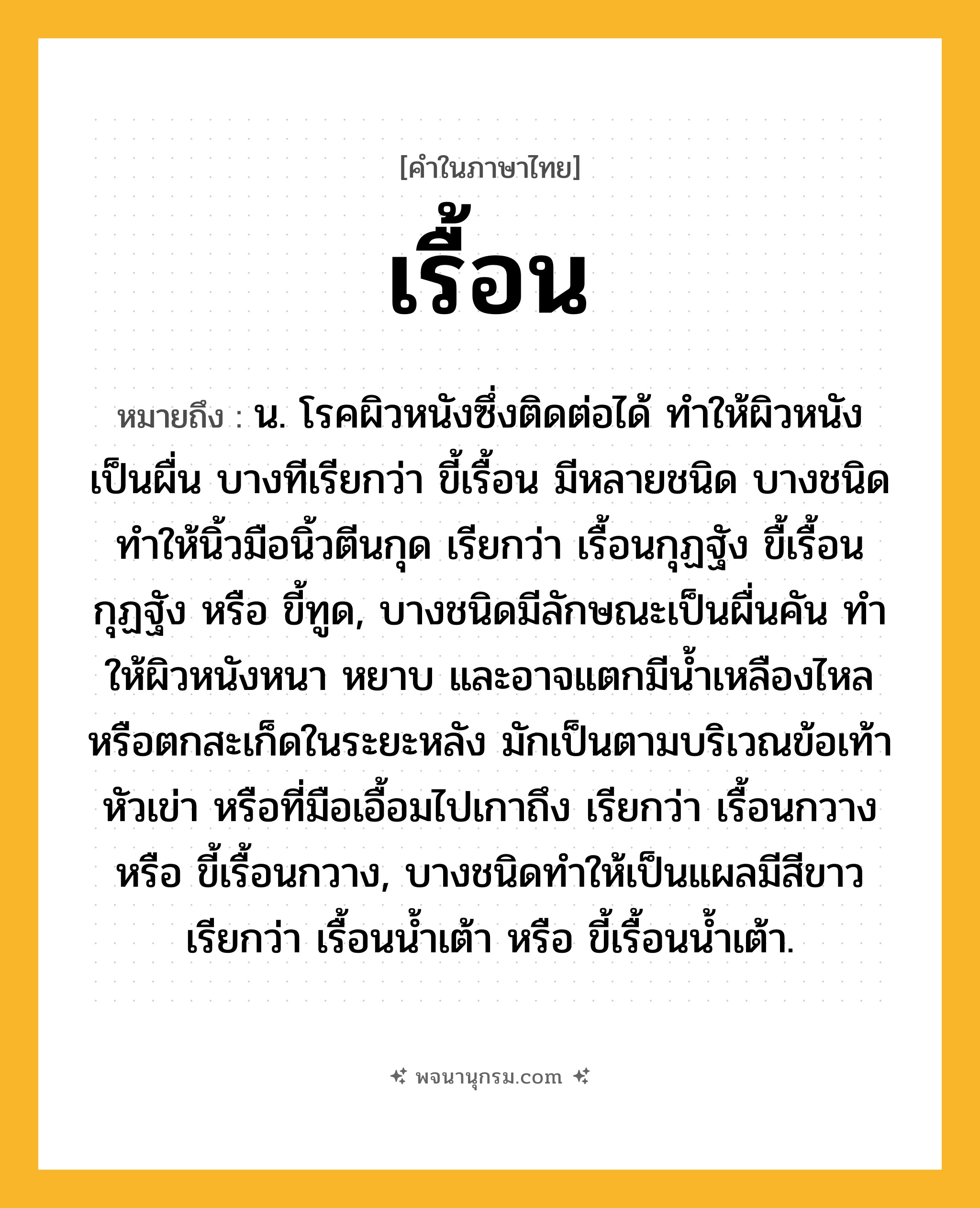 เรื้อน ความหมาย หมายถึงอะไร?, คำในภาษาไทย เรื้อน หมายถึง น. โรคผิวหนังซึ่งติดต่อได้ ทำให้ผิวหนังเป็นผื่น บางทีเรียกว่า ขี้เรื้อน มีหลายชนิด บางชนิดทำให้นิ้วมือนิ้วตีนกุด เรียกว่า เรื้อนกุฏฐัง ขื้เรื้อนกุฏฐัง หรือ ขี้ทูด, บางชนิดมีลักษณะเป็นผื่นคัน ทําให้ผิวหนังหนา หยาบ และอาจแตกมีนํ้าเหลืองไหลหรือตกสะเก็ดในระยะหลัง มักเป็นตามบริเวณข้อเท้า หัวเข่า หรือที่มือเอื้อมไปเกาถึง เรียกว่า เรื้อนกวาง หรือ ขี้เรื้อนกวาง, บางชนิดทําให้เป็นแผลมีสีขาว เรียกว่า เรื้อนนํ้าเต้า หรือ ขี้เรื้อนน้ำเต้า.